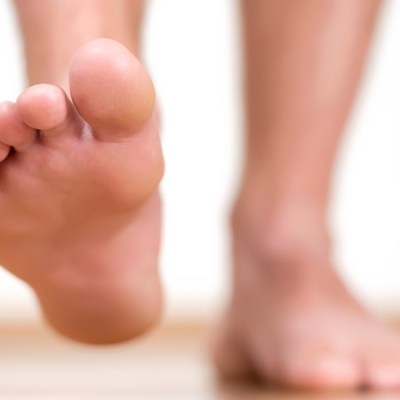 Plantar Fasciitis